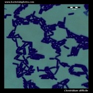 clostridium difficile under microscope